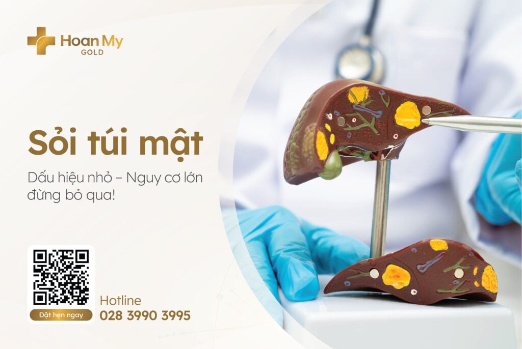 Những điều cần biết về bệnh sỏi túi mật